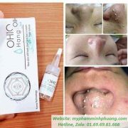 Ohio-Hangul-tinh-chat-u-mun (2)_result