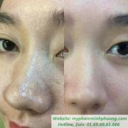 Tinh-Chat-U-mun-Ohio-Hangul-Han-Quoc-4_result