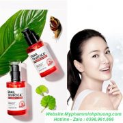 Serum-tri-seo-ro-tinh-chat-oc-sen-some-by-han-quoc-me-581x582