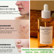 Tinh-chat-rau-ma-skin1004-madagascar-centella-asiatica-100-ampoule-100ml-743x673