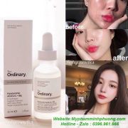 TINH-CHAT-CAP-NUOC-ORDINARY-HYALURONIC-ACID-2% +B5-2