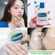 sua-rua-mat-CETAPHIL-NHO sua-rua-mat-CETAPHIL-NHO