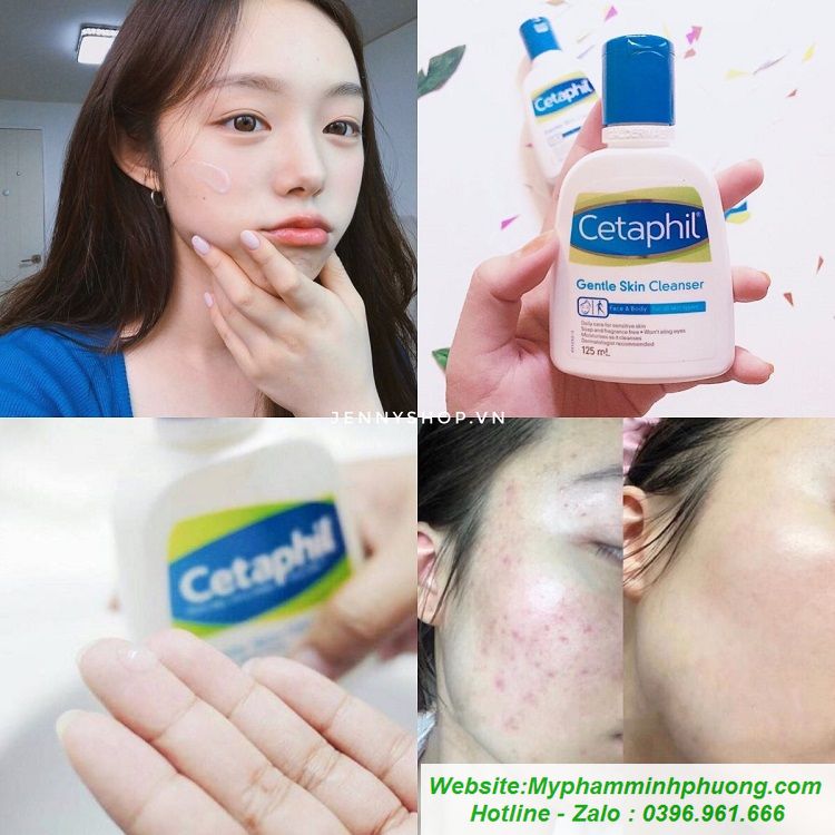 sua-rua-mat-CETAPHIL-NHO