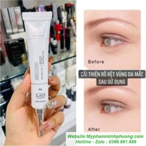 kem-duong-mat-kem-mat-LJGO SNAIL-WRINKLE-CARE-CHA-SKIN-EYE-CREAM