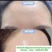 tinh-chat-serum-b5-gc-dung-cho-da-dau