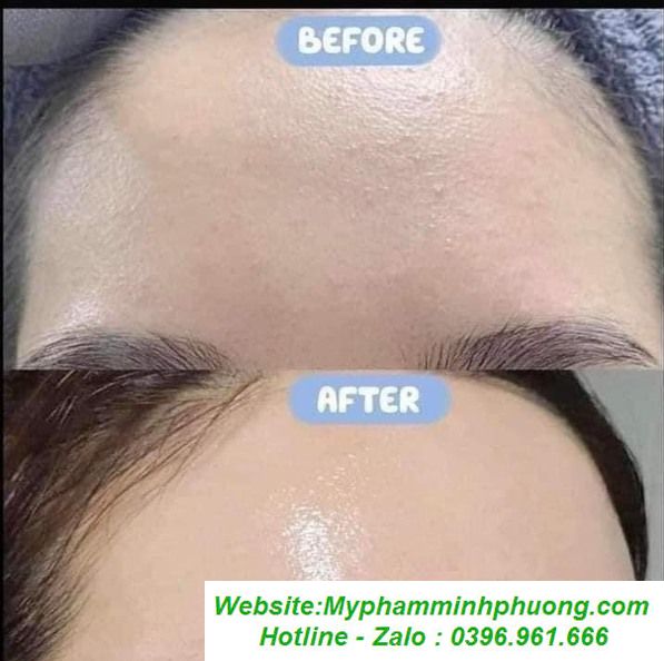 tinh-chat-serum-b5-gc-dung-cho-da-dau